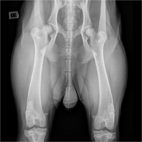 Radiografie van een patiënt met heupdysplasie